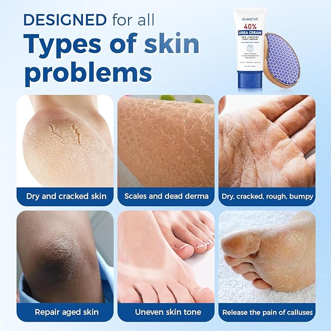 OUKEYA Urea Cream 40 Percent Tube, Urea Cream 40 Percent For Feet Maximum Strength, with Foot Callus Remover, Nano Glass Foot File