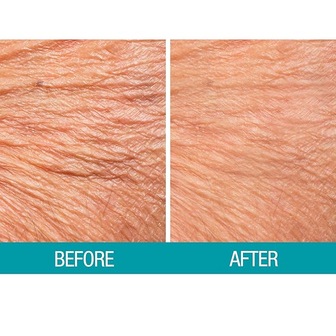 Dermactin Crepe Skin Firming Cream 2.5 oz. (PACK OF 2)