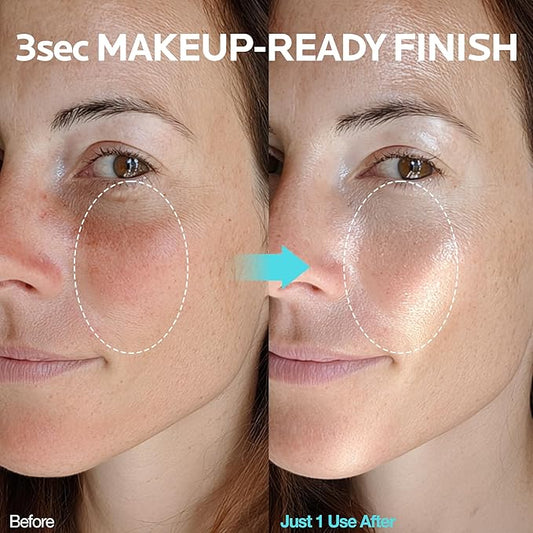 Ice Sorbet Toner Pads | Skin Prep Wipes for Puffiness, Under Eye Bags & Instant Face Lift | Gel Pads for Sunburn Relief & After Sun with 30% Glacier Water & Caffeine | 7.43 Fl Oz / 60 Count