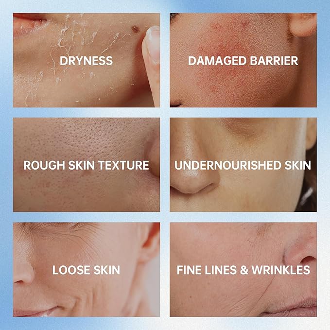 VGO Snail Mucin 92% Face Moisturizer – Anti Aging, Skin Repair & Hydrating Face Cream with Ceramide & Vitamin E, 1.76 oz