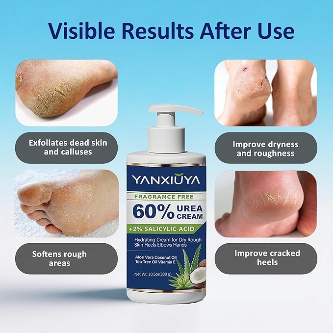 60% Urea Cream for Feet with 2% Salicylic Acid, Fragrance-Free Foot Cream and Urea Lotion for Cracked Heels, Dry Skin & Callus Remover, Maximum Strength Moisturizing Cream, 10.5 oz