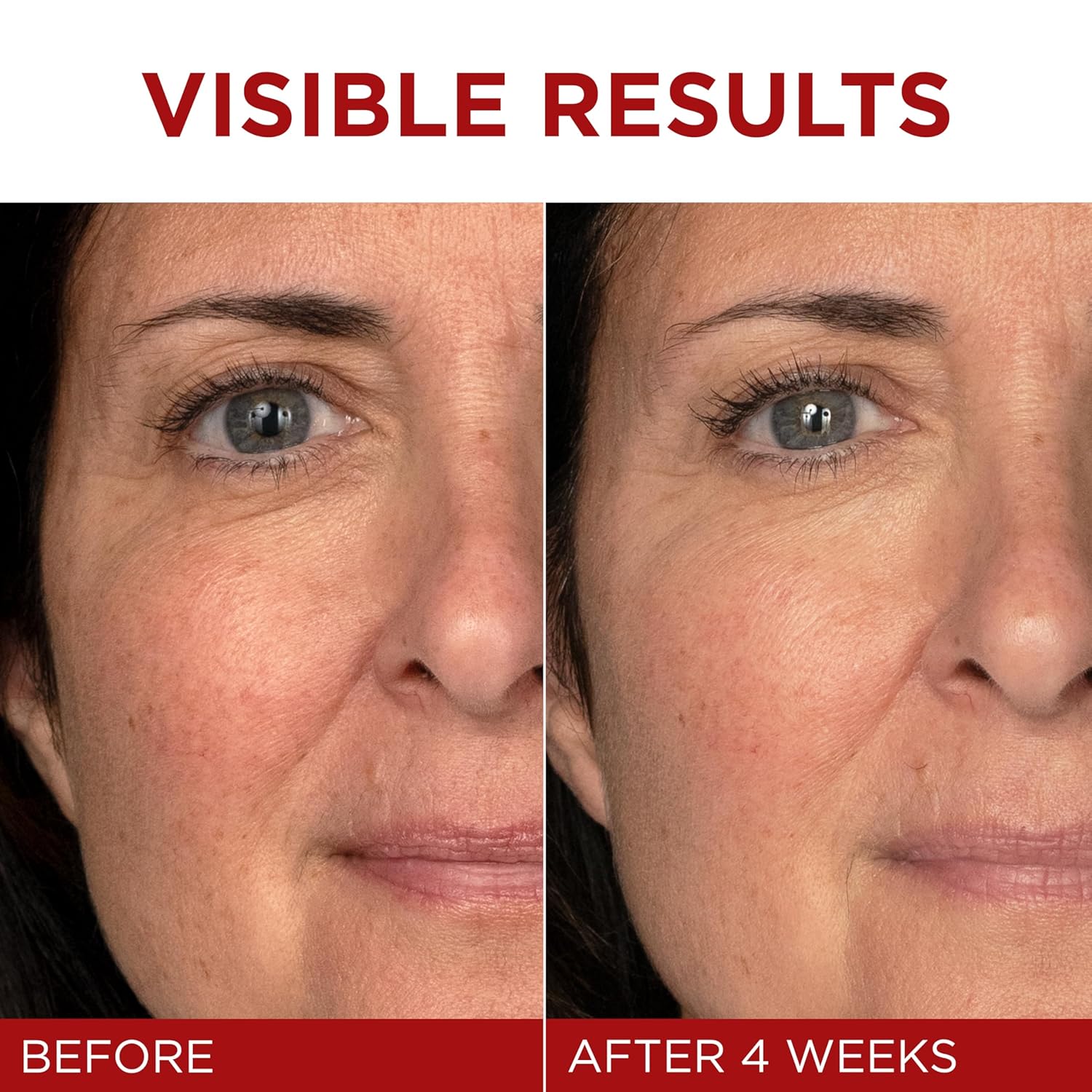 Anti-Aging Face Cream with Retinol, Vitamin C & Hyaluronic Acid – Wrinkle Repair Moisturizer for Mature Skin 💧✨ | Revitalift Triple Power Lifting Cream, 1.7 Oz