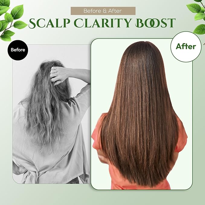 Dry Itchy Scalp Shampoo, Natural Shampoo for Women & Men with HOT SPRING Yeast & Green Algae and Amino Acids, Moisturizing SHAMPOO Made in Japan 10.1 Fl Oz DAILY MILD