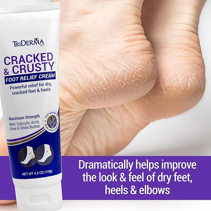 TriDerma Cracked & Crusty™ Healthy Foot Cream Moisturizes, Softens and Heals Dry Feet, Cracked Heels and Dry Elbows with Salicylic Acid, Urea, Shea Butter, AP4 Aloe and Vitamins, 4.2 Ounces