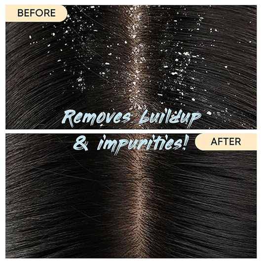 Charcoal Shampoo Bar 2.0 - Hydrating & Moisturizing Natural Hair Soap Bar Shampoo for Excess Oil Build-Up & Scalp Nourishment - Bathing Soap Solid Shampoo for All Hair Types (120g, 4.23oz)