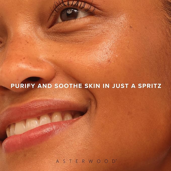 Asterwood Hypochlorous Acid Spray for Face - Targets Acne, Redness, Irritation - Multi-Purpose Skin Repair - Antibacterial, Antimicrobial - After Gym/Post-Workout Facial Mist - 4 Fl Oz