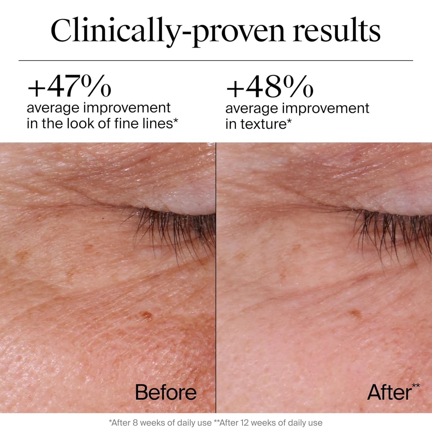 Retinol Face Moisturizer – Fragrance-Free Anti-Aging Cream, 1.7 oz 💧✨