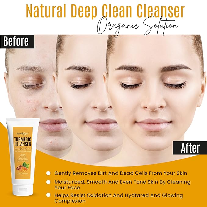 Turmeric Facial Cleanser – Natural Anti-Aging Exfoliating Turmeric Face Wash for Glowing Skin – Helps Clear Acne Scars, Dark Spots, Sun Damage & Discoloration – 5 oz