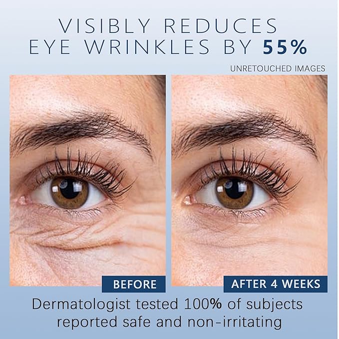 Vitality-Fill Boosting Eye Cream, Natural Anti Aging Under Eye Cream Lift & Firm,Reduce Wrinkles,Fine Lines,and Under Eye Bags,Dark Circles Under Eye Cream