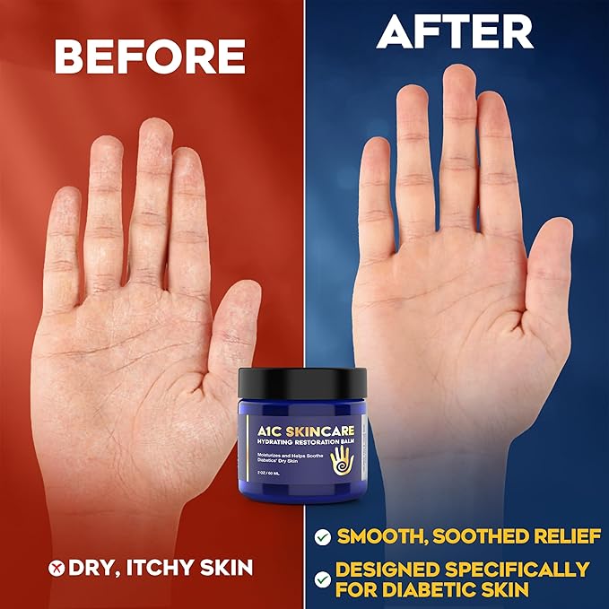 Diabetic Care Balm - Balm for Diabetics Care with Beeswax & Vitamin E, Diabetic Moisturizer For Dry, Cracked Hands & Feet, Long-Lasting Hydration for Sensitive Skin, 2 oz