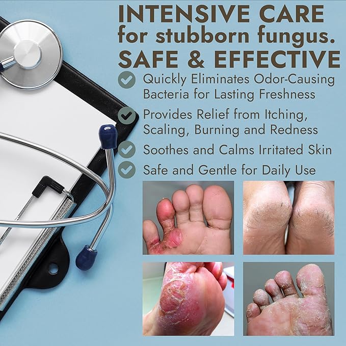 Foot Cream with Tea Tree Oil | Antifungal Cream to Soothes Cracked Heels, Dry Skin & Itchy Feet | Helps with Athlete’s Foot, Nail Fungus & Jock Itch | Relieves Itching & Burning | 4.05 fl oz