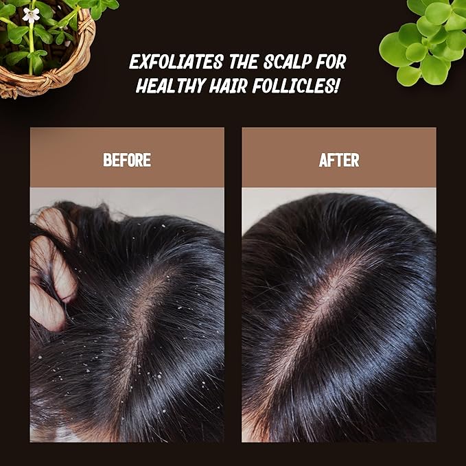 Brahmi Scrub & Cleanser – Deep Exfoliation & Cleansing – Best for Hair Care & Hair Growth - Instant Relief for Irritated Scalps – Restorating Ayurvedic Hair Exfoliator for Men & Women - 6.7oz