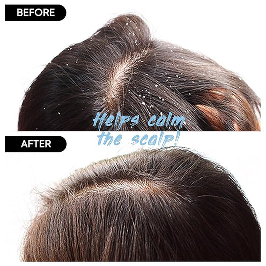 Red Bean Shampoo Bar 2.0 - Hydrating & Moisturizing Natural Hair Soap Bar Shampoo for Hair Color & Scalp Nourishment - Bathing Soap Solid Shampoo for All Hair Types (120g, 4.23oz)