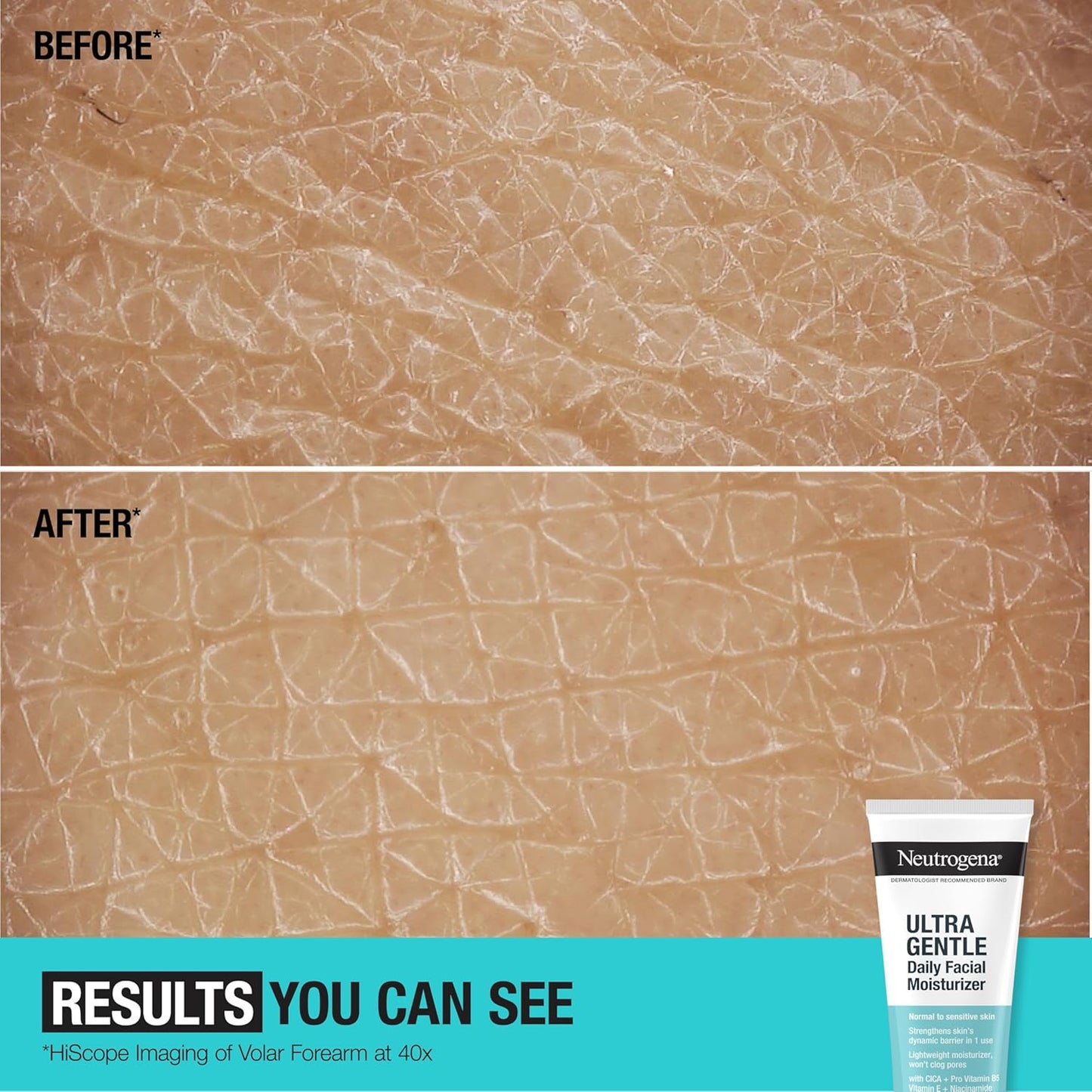 Fragrance-Free Facial Moisturizer for Sensitive Skin – 3.4 oz 🌿💧