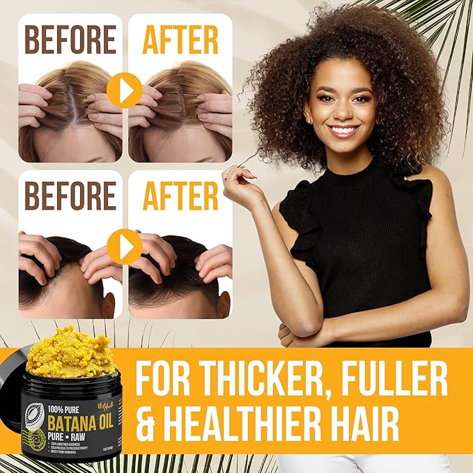 Vie Naturelle Batana Oil for Hair Growth from Honduras – Raw Unrefined – Natural Moisturizer for Skin & Hair – Traditionally Cold-Pressed from Honduran Palm Nut - 04 oz