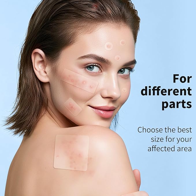 Large Pimple Patches for Face, 7 Sizes 210 Counts XL Acne Patches, Big Hydrocolloid Bandages for Body, Chin, Forehead, Chest, Back Zit Breakouts (Strip, Square, Round)