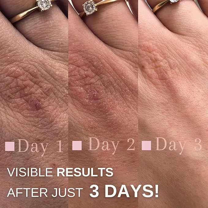 swederm Hudsalva 1.69 Oz - Healing Ointment with Vitamin E - Foot and Hand Cream for Women - Full Body Moisturizer for Dry Skin - Quickly Absorbing - Made in Sweden - Pink