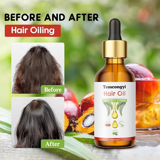 Rosemary hair oil, containing castor oil, batana oil, peppermint oil, promotes hair growth and prevents hair loss in men and women