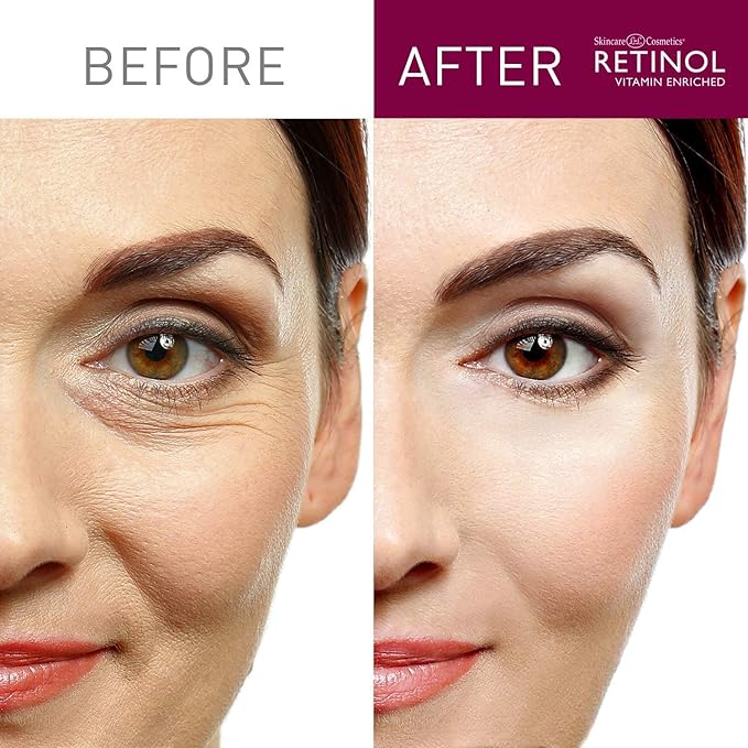 Retinol Skin Brightener – The Original Retinol Brand – Skin Tone Corrector Smooths & Rejuvenates Face for Healthy Glow – Minimizes Fine Lines & Wrinkles with Plant & Fruit Extracts, Vitamin A, C & E