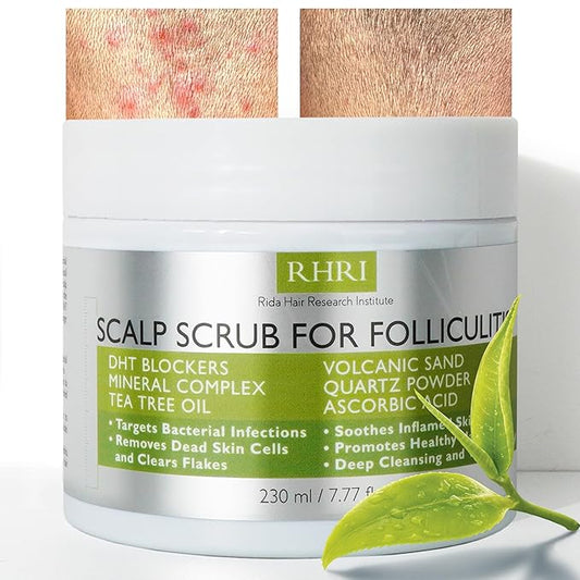 Anti Fungal Folliculitis Scalp Scrub Pre Shampoo for Seborrheic Dermatitis, Dandruff, Psoriasis, and Itchy Dry Scalp Relief