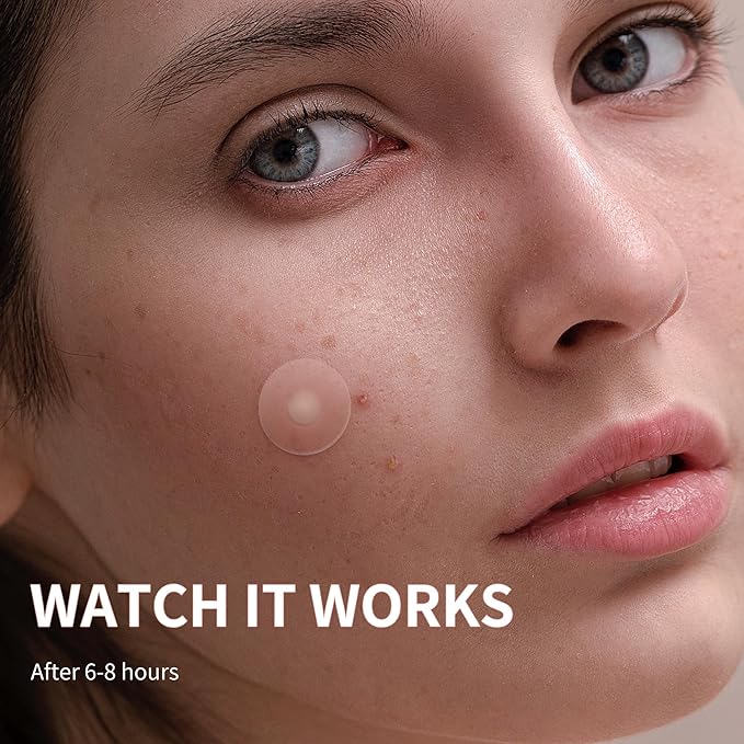 Large Acne Pimple Patches for Face, 6 Sizes 142 Counts Big Hydrocolloid Bandages for Body, Forehead, Chin, Nose, Neck & Chest(Round, Oval, Moon, Square)