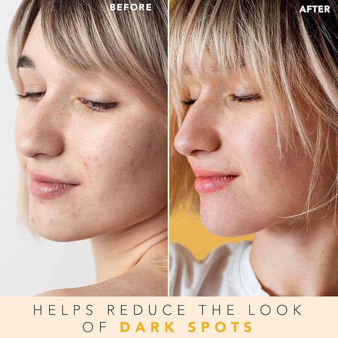 Vitamin C Face Toner - USA Made with Natural & Organic Ingredients, Alcohol-Free Skin Brightening Facial Toner for Sensitive and Aging Skin, Pore Minimizing Face Mist for Women and Men