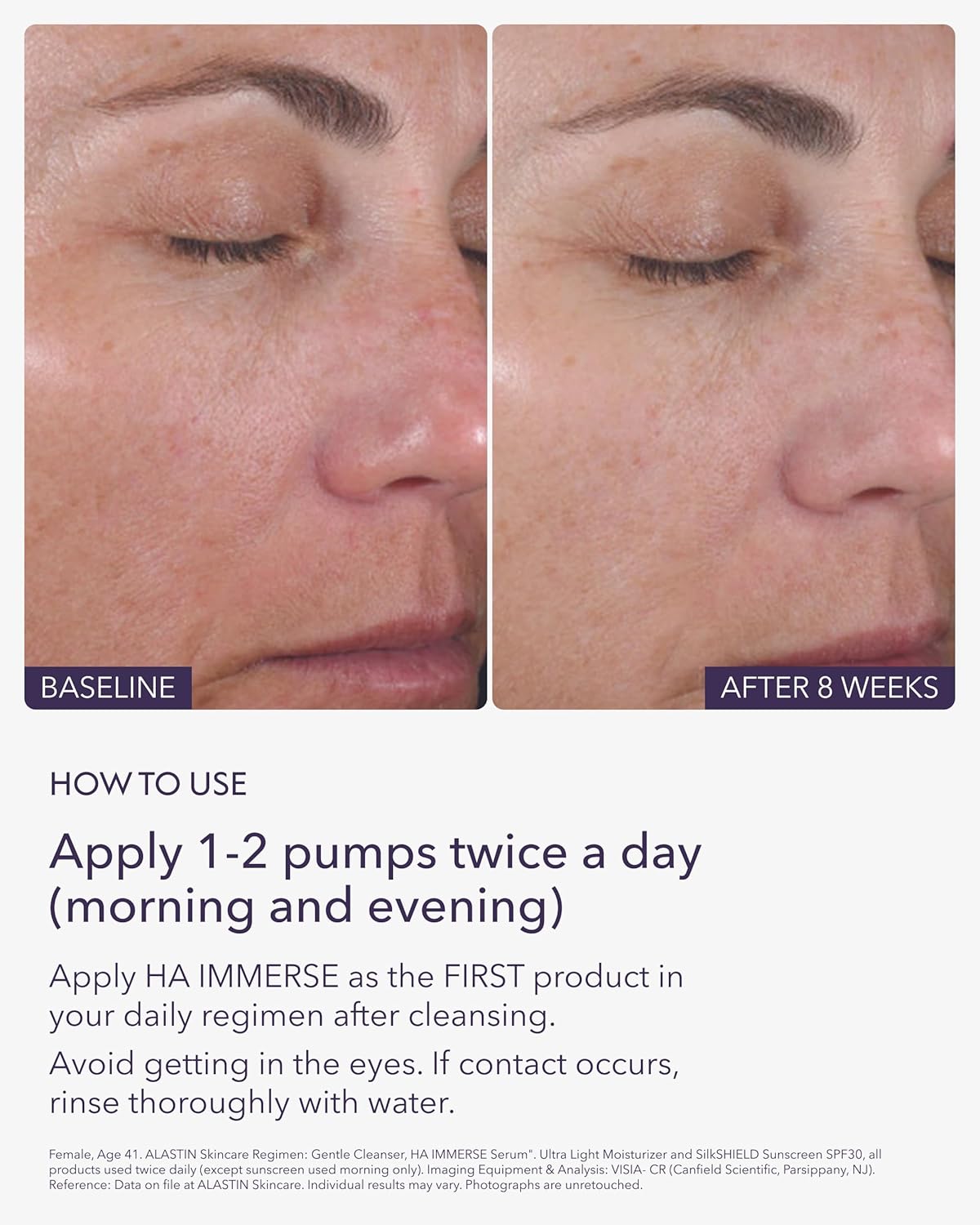 Hyaluronic Acid HA Immerse Face Serum – Deep Hydration & Moisture Locking Serum for Dry, Dehydrated & Mature Skin | Restorative Anti-Aging Formula for Radiant, Glowing Complexion | 1 Fl Oz