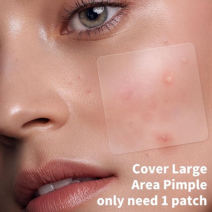 Large Pimple Patches for Face, 7 Sizes 210 Counts XL Acne Patches, Big Hydrocolloid Bandages for Body, Chin, Forehead, Chest, Back Zit Breakouts (Strip, Square, Round)