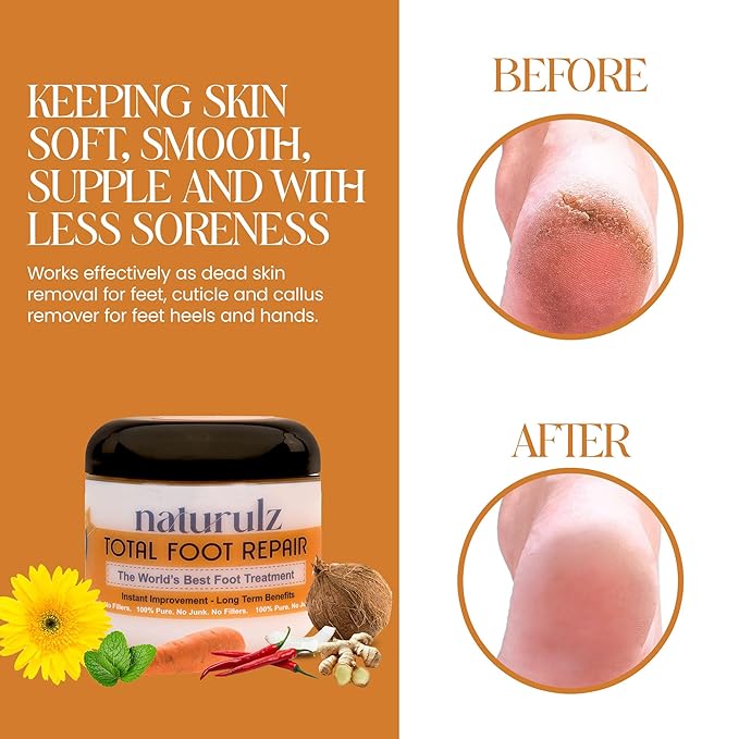 Naturulz Total Foot Repair 4oz – No Junk Foot Cream for Dry, Rough Skin & Cracked Heels, Lightweight & Compact Moisturizer for Feet, Knees, Elbows & Hands, Softens, Repairs & Smooths Cracked Skin
