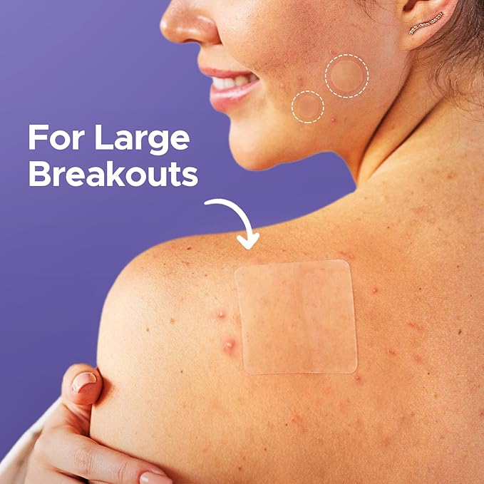 LitBear Acne Patches for Large Breakouts, Hydrocolloid Pimple Patches for Zit and Blemish, Face, Chin, Back and Body With Tea Tree Oil