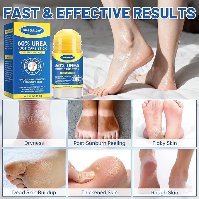 60% Urea + 2% Salicylic Acid Foot Cream–Ultra-Moisturizing Formula, Exfoliates Dead Skin, Softens Dry, Cracked Skin on Feet, Knees, Hands, Elbows. Helps soften callused, rough, or tender areas 2.82oz