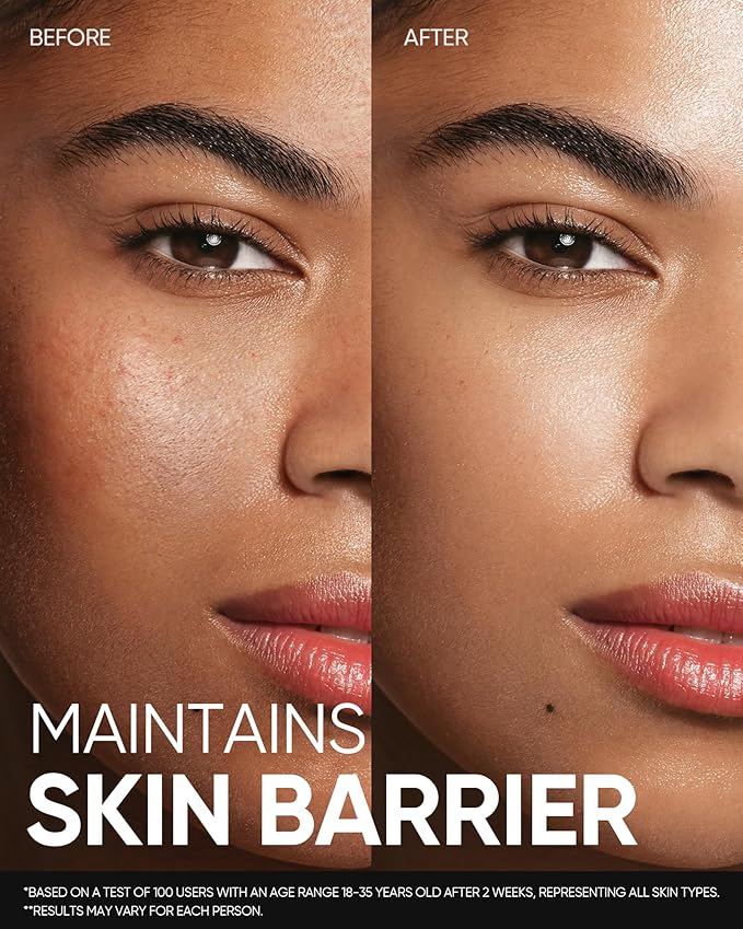 5X Ceramide Soothing Toner, Hydrating Skin Barrier Repair Calms Redness Facial Toner with Probiotics & Calendula for Sensitive & Dry Skin, Non-Alcohol, Cruelty-Free, Vegan Skincare