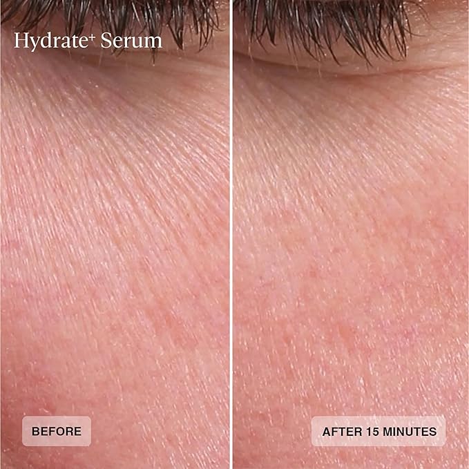 Senté Hydrate+ Serum | Hyaluronic Acid with HSA for Glass Skin | Deep Hydration, Barrier Support & Post-Procedure Care | Fast-Absorbing | Calms & Soothes | Paraben, Cruelty, Fragrance Free | 1.0 oz