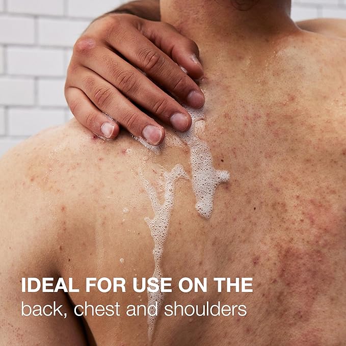 Neutrogena Salicylic Acid & PHA Stubborn Acne Body Wash, Exfoliating Cleanser Acne Treatment for Chest & Shoulder, Gently Clears, Exfoliates & Helps Prevent Breakouts, Fragrance Free, 8.5 Fl Oz