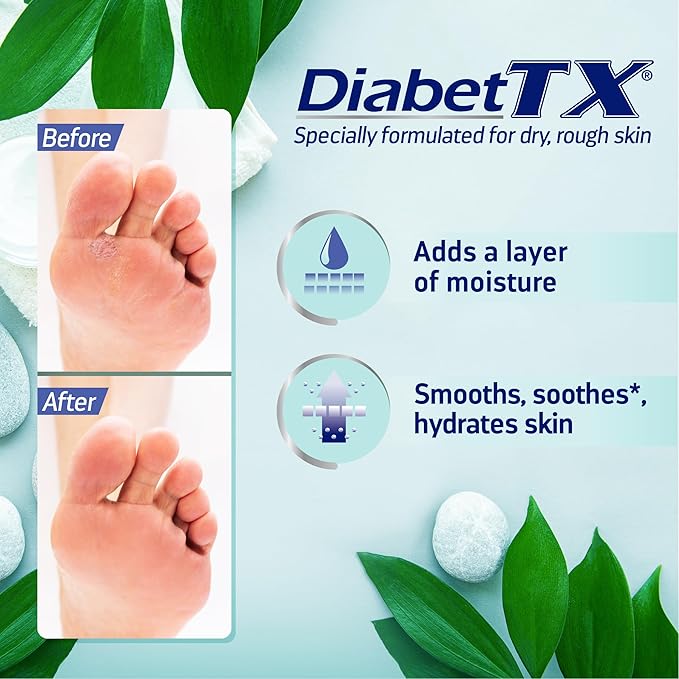 Goicoechea Diabet TX Diabetic Lotion for Dry Skin | Soothing Hydrating Cream for Women and Men, Moisturizer for Hands, Legs, Feet, and Body, Extra Dry Skin Support, 13.5 Oz, 1-Pack