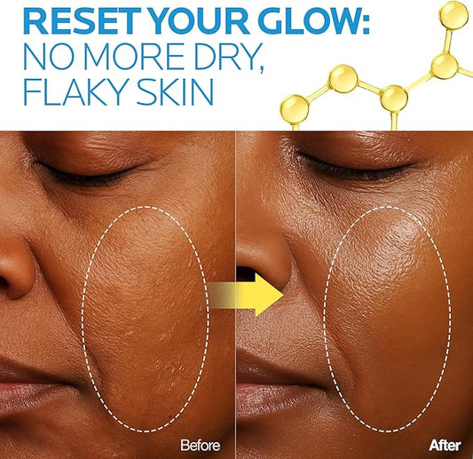 Glow Reset Toner | Korean Clinic Skincare - Thioctic Acid & Niacinamide 5% | Gentle Exfoliation w/Pumpkin Extract | Fades Melasma & Hyperpigmentation | Deep Hydration | 250ml /8.45 Fl Oz