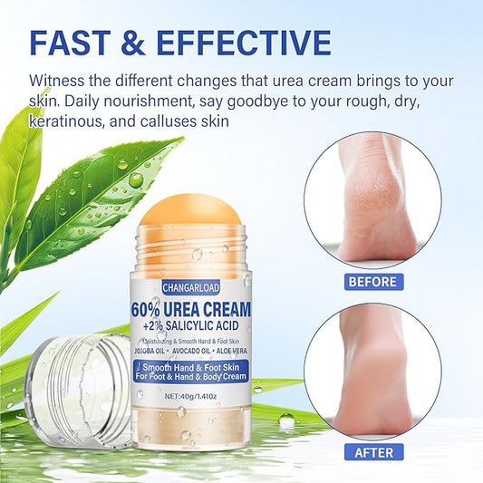 Urea Cream 60 Percent For Feet Maximum Strength - Intensive Repair Dry Cracked Skin, Urea Cream For Feet, Foot Cream For Dry Cracked Heels, 1 Pcs - 1.41 Oz