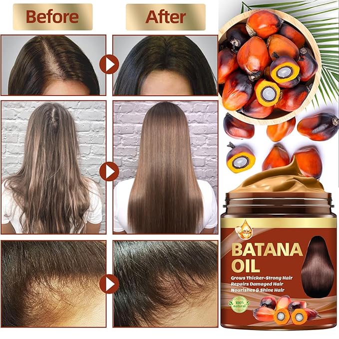 Batana Oil for Hair Growth & Rosemary Oil for Hair Growth,Raw Batana Hair Mask Rosemary Hair Growth Serum,Hair Loss Treatment,Hair Care for Dry Damaged Hair,Promotes Hair Thickness for Men Women