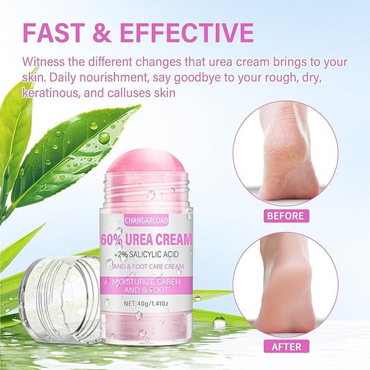 Urea Cream 60 Percent For Feet Maximum Strength - Intensive Repair Dry Cracked Skin, Urea Cream For Feet, Foot Cream For Dry Cracked Heels, 1 Pcs - 1.42 Oz