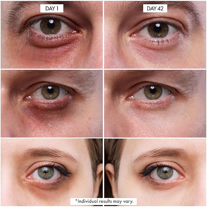 Dr Crazy Eye CPR Repairing Under Eye Cream for Dark Circles, Puffiness & Bags Under Eyes – Caffeine Serum for Wrinkles, Fine Lines – 30ml