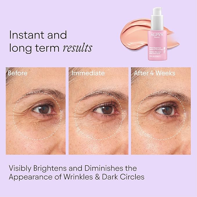 ALPYN Instant Bright Eye with Peptides & Niacinamide | Brightens Dark Circles, Visibly Firms & Softens Fine Lines | 0.5 Fl Oz / 15 ml