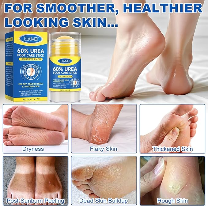 Urea Cream Stick 60% plus 2% Salicylic Acid, Foot Cream for Dry Cracked Heels and Feet, Foot Dead Skin Cuticle Callus Remover, Foot Moisturiser