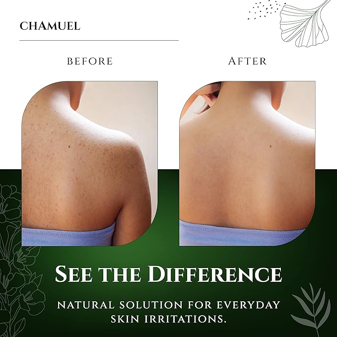 Chamuel Tea Tree Body Wash - Made With Natural Ingredients To Fights Itchy Skin, Body Odor, Athlete's Foot, Jock Itch & Toenails Issues - Organic Scented - Men & Women (11.8oz)