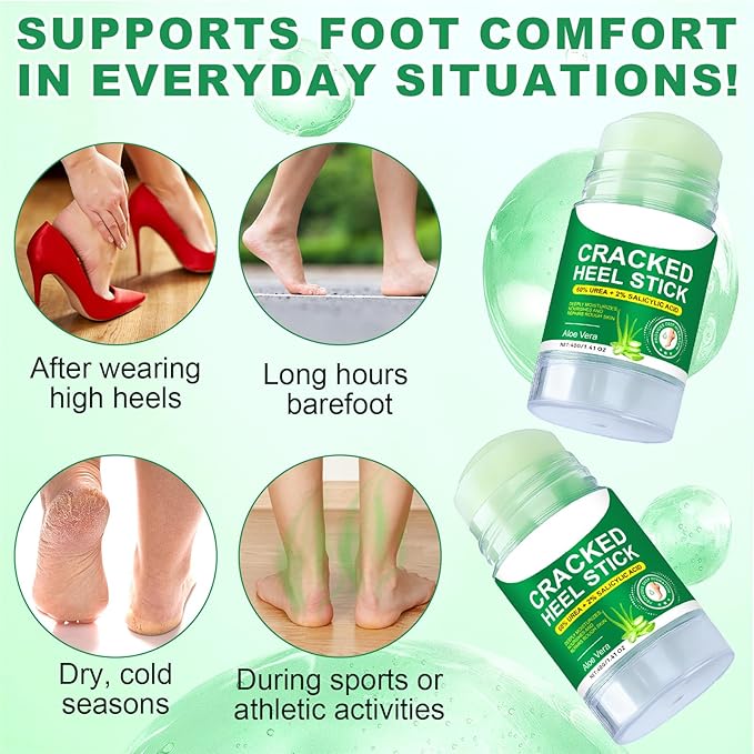 60% Urea Cream plus 2% Salicylic Acid, Cracked Heel Repair Balm Stick for Dry Cracked Feet Treatment,Foot Hand Cream Stick for Smoothing Hands Elbows Feet Knees,Moisturizes and Hydrates the Dry Skin