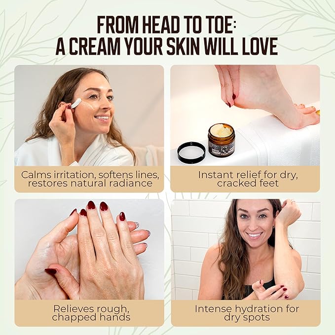 Grass-Fed Beef Tallow and Manuka Honey Balm, Eczema Face & Body Cream, Moisturizer for Dry Skin with Shea Butter, Almond & Jojoba Oil, Beeswax, Arrowroot, Vitamin E - Unscented - Made in Canada, 2 oz