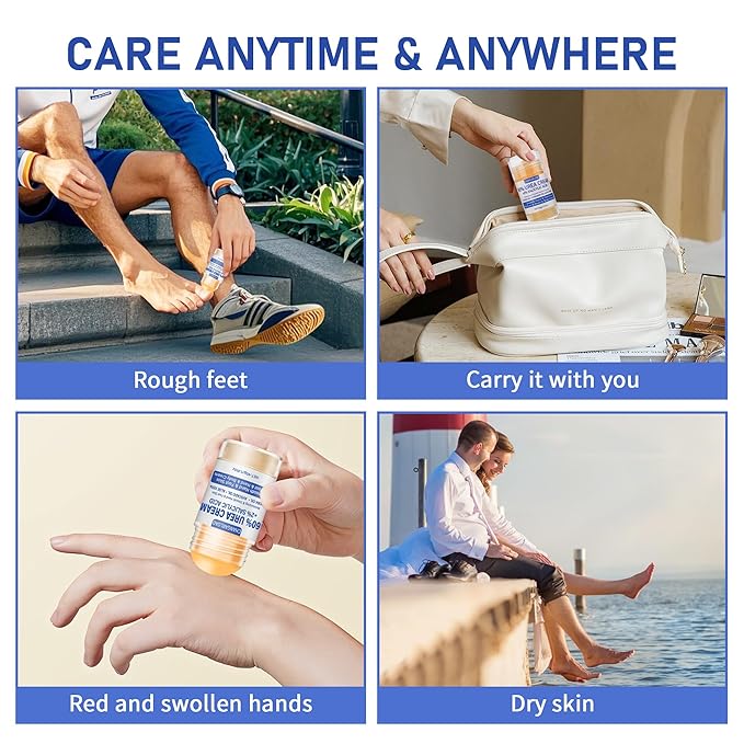 Urea Cream 60 Percent For Feet Maximum Strength - Intensive Repair Dry Cracked Skin, Urea Cream For Feet, Foot Cream For Dry Cracked Heels, 1 Pcs - 1.41 Oz