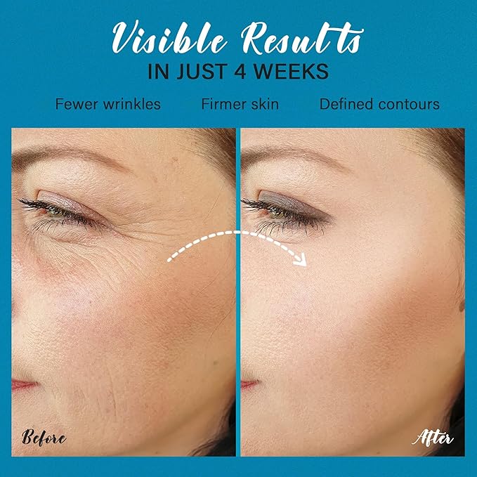 Tighten and Lift Neck Cream: Instant Face Lift Cream - 6-in-1 Anti-Aging Face Moisturizer for Anti-Wrinkle, Firm - Collagen, Retinol, Peptides & Hyaluronic Acid Neck Firming Cream for Skin Care