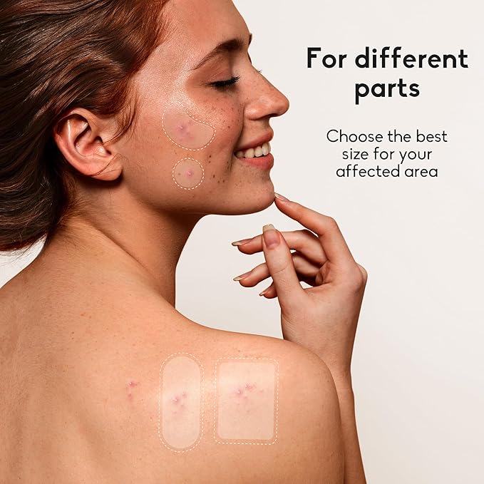 Large Acne Pimple Patches for Face, 6 Sizes 142 Counts Big Hydrocolloid Bandages for Body, Forehead, Chin, Nose, Neck & Chest(Round, Oval, Moon, Square)