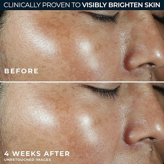 RoC Multi Correxion Revive + Glow Vitamin C Sunscreen Broad Spectrum SPF 30 Face Moisturizer (1.7 oz) with Retinol Eye Cream Packette