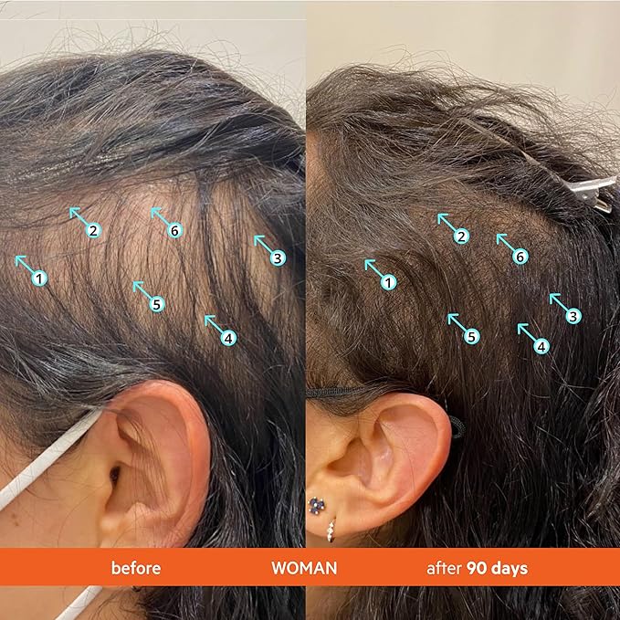 DS Labs Revita Shampoo & Conditioner Kit, 205 mL – Scalp First System for Fuller Looking, Volumized Hair, Lightweight Hydration, Sulfate & Silicone Free, Color Safe, For Men & Women